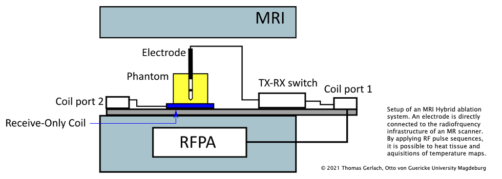 MEMoRIAL-M1.9_MRIHybridAblationSystem.png