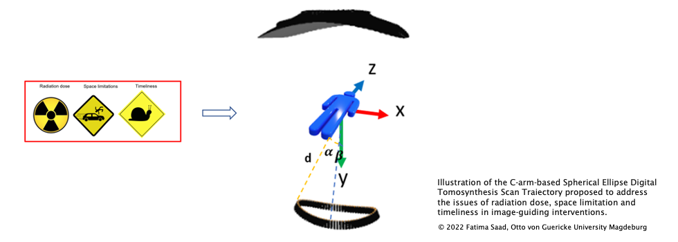 MEMoRIAL-M1.11_C-arm_SEDTScanTrajectory.png