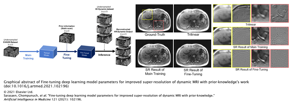 MEMoRIAL-M1.7_FTSuperResDyn_Graphical_Abstract.png